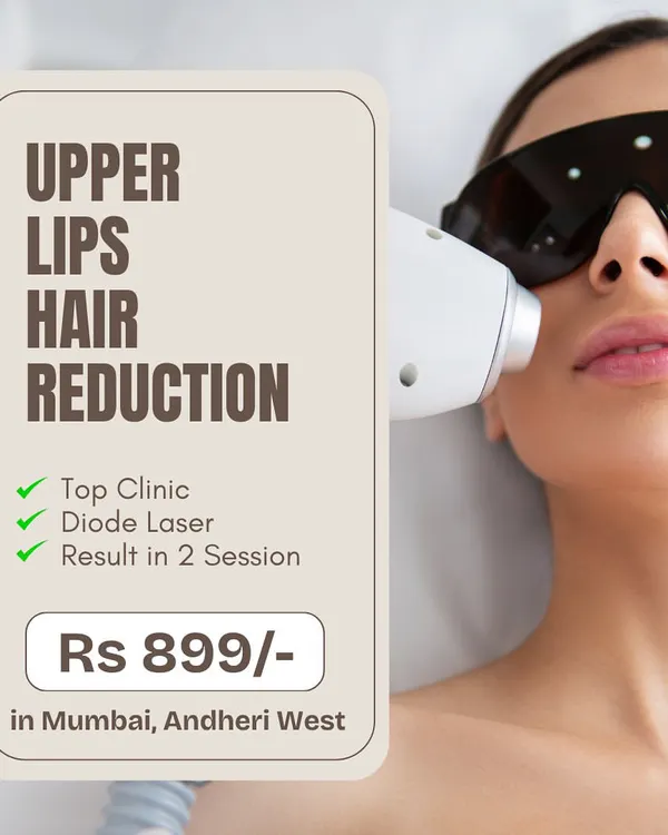 Getting started with laser hair reduction can be easy and affordable. We offer targeted treatments like this one for the upper lips, using our advanced Diode laser to deliver visible results in just a couple of sessions.