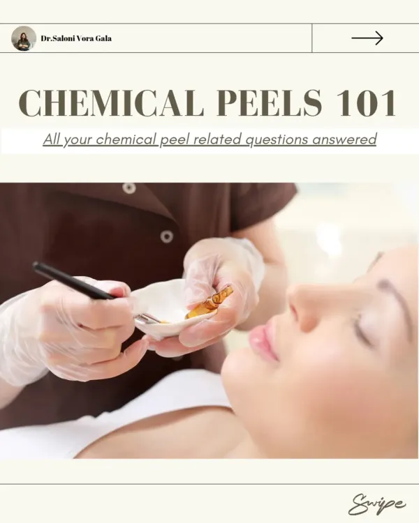 This is your 'Chemical Peels 101' guide, designed to answer all your questions. Here you can see a peel being professionally applied, a process that is controlled, safe, and tailored to the patient's skin.