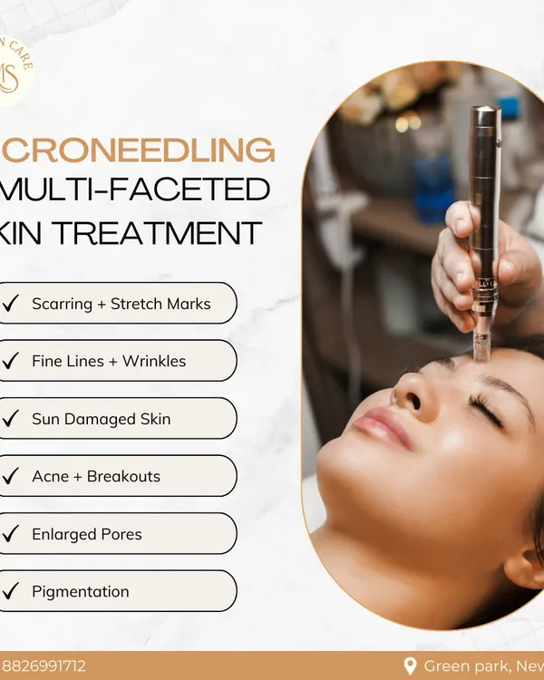 Microneedling is a versatile treatment that addresses multiple skin concerns at once. As this graphic shows, it is effective for scarring, stretch marks, fine lines, sun damage, enlarged pores, and pigmentation by promoting skin regeneration.