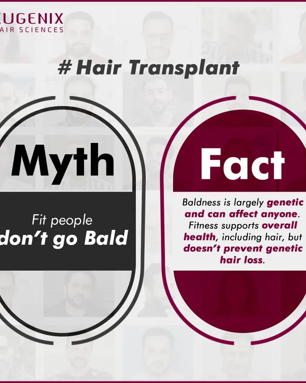 A series of graphics debunking common myths about fitness and hair loss, such as whether exercise, sweating, or high-protein diets cause baldness.