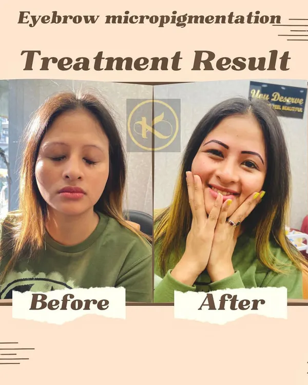 See the amazing transformation possible with eyebrow microblading. This client wanted fuller, more defined brows, and we achieved a beautiful, natural-looking result that she was thrilled with. This semi-permanent makeup technique can redefine your entire look.