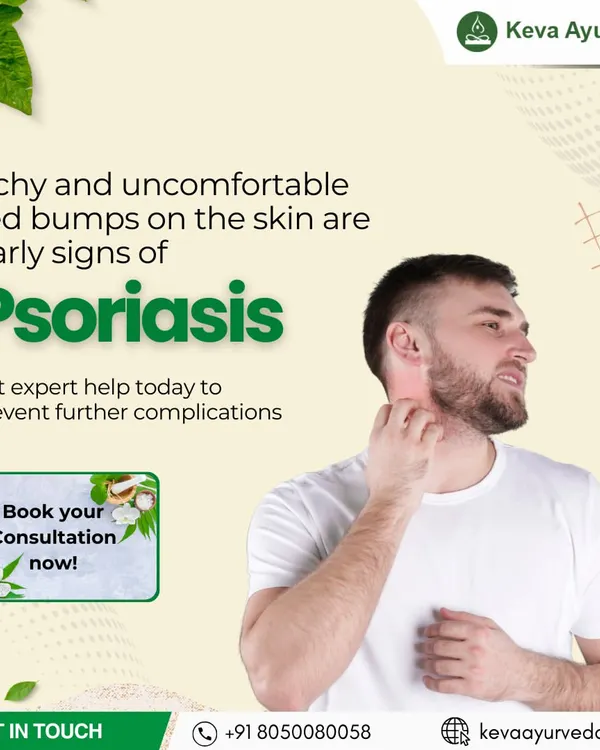 Itchy and uncomfortable red bumps can be early signs of Psoriasis. We provide expert Ayurvedic help to manage the condition and prevent further complications.
