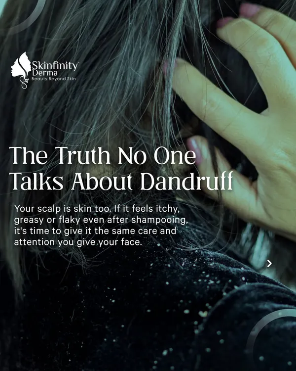 The truth no one talks about dandruff is that your scalp is skin too. If it's itchy or flaky even after shampooing, it needs the same level of care you give your face.