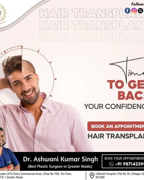 This visual shows the transformative potential of a hair transplant. My focus is on designing a hairline that suits your facial structure, creating a result that helps you regain your confidence.