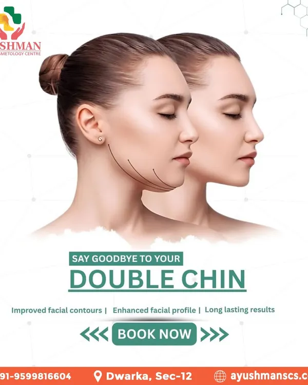 A defined jawline can dramatically enhance your facial profile. We offer specialized, non-surgical double chin reduction treatments designed to target submental fat, resulting in improved facial contours and a sharper, more confident look with long lasting results.