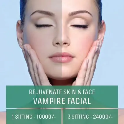 A before and after comparison of our Vampire Facial. This treatment rejuvenates the skin by using your own plasma to promote healing and collagen production, resulting in a brighter, smoother complexion.