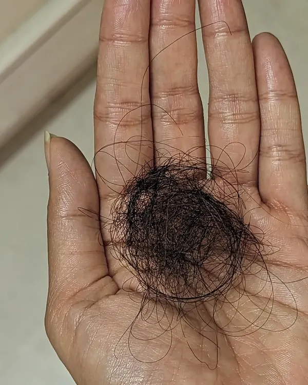 We often hear that losing 100 hairs a day is normal, but what does that actually look like? This image shows a ball of 100 medium-length hairs to help you gauge if your hair fall is within the normal range.