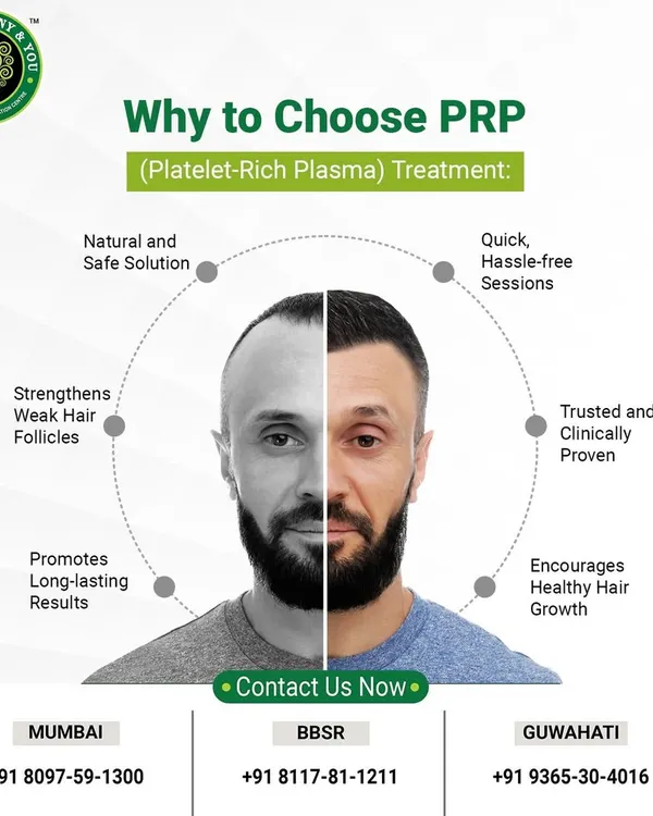 This visual represents the clear transformation possible with PRP treatment. It is a trusted and clinically proven method to encourage healthy hair growth, moving from thinning hair to a fuller, more confident look.