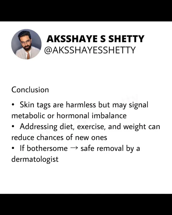 Skin tags are often harmless, but they can be a sign of underlying metabolic issues like insulin resistance. Addressing diet, exercise, and weight management can help reduce the risk of new ones forming.