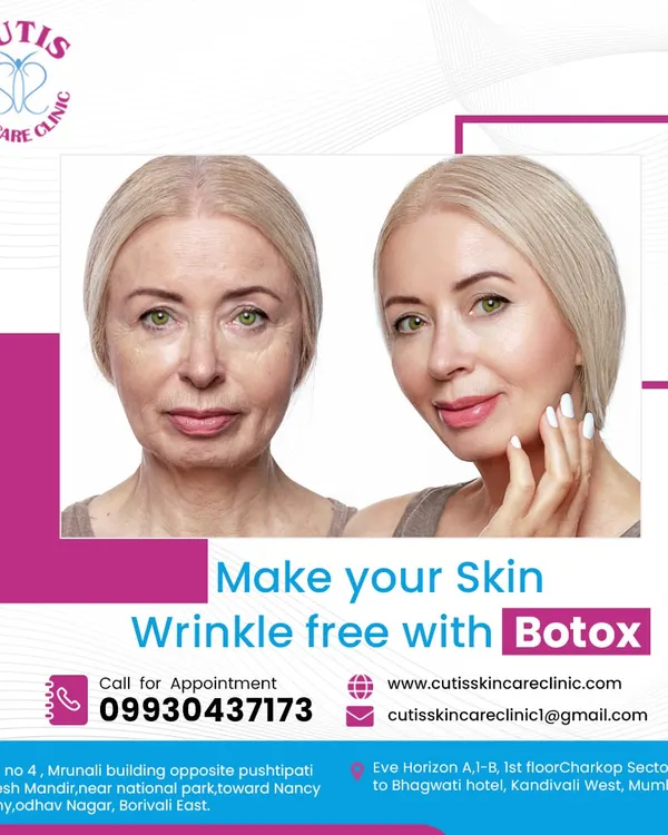 A clear before-and-after comparison demonstrating the effectiveness of our Botox treatment for reducing deep-set wrinkles and fine lines, resulting in a significantly smoother and more youthful complexion.