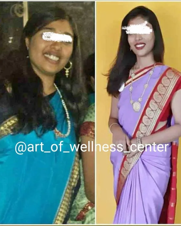 A side by side comparison showing a client's significant weight loss journey. Her posture, confidence, and overall appearance improved dramatically with a balanced diet and lifestyle changes.