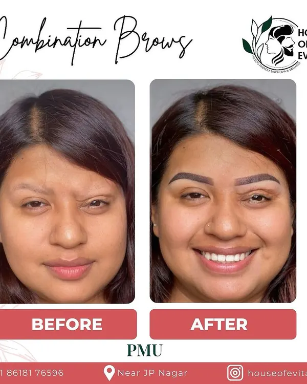 This is the power of Combination Brows. I blended fine, hair-like microblading strokes with soft powder shading to create a defined yet natural-looking brow that beautifully frames the face and brings out her smile.