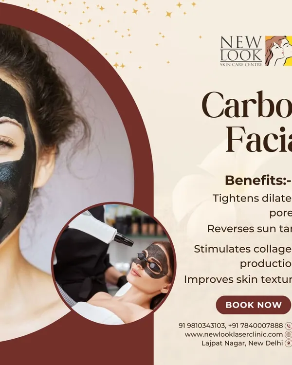 The Carbon Laser Facial, also known as a Hollywood Peel, offers multiple benefits in one session. It effectively tightens enlarged pores, reverses sun tan, stimulates collagen, and improves overall skin texture for a smoother complexion.