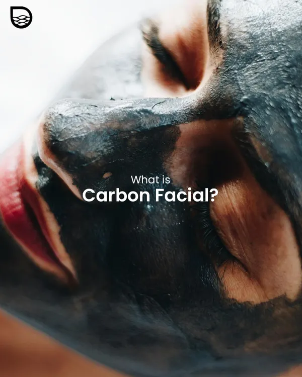 A close-up of the carbon mask application, which is the first step of a Carbon Facial. This treatment is specifically designed to target common issues like oily skin, acne, and dullness.
