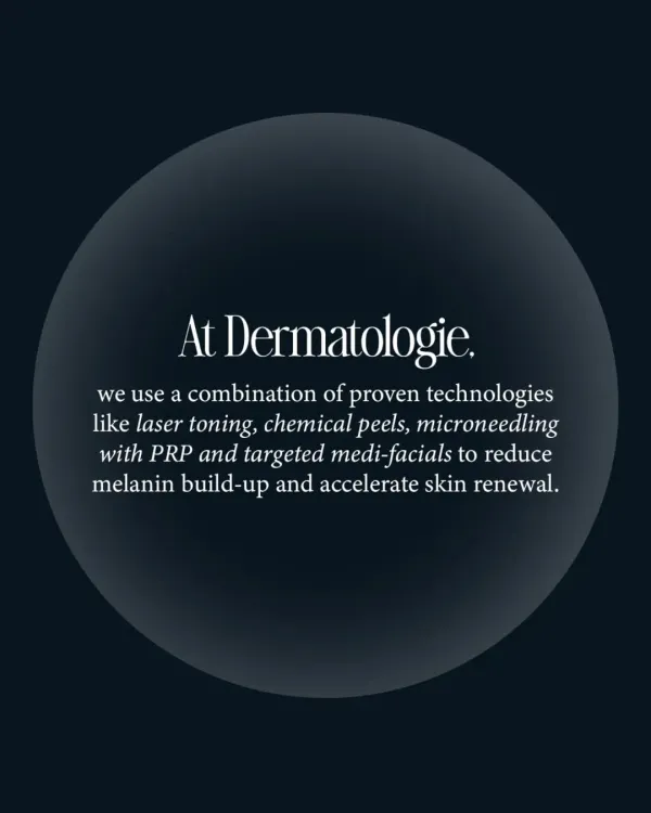 This graphic summarizes my approach to treating hyperpigmentation. I use a combination of proven technologies like laser toning, chemical peels, microneedling with PRP, and targeted medi-facials to reduce melanin build-up and accelerate skin renewal.