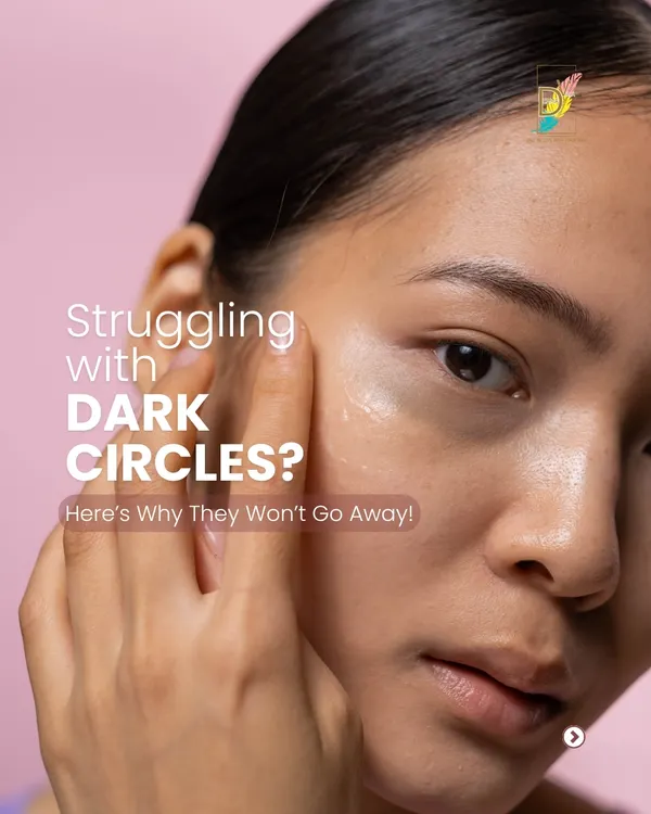 Are you struggling with dark circles that won't go away? It's often more complex than just needing more sleep. Let's explore the real reasons behind them.