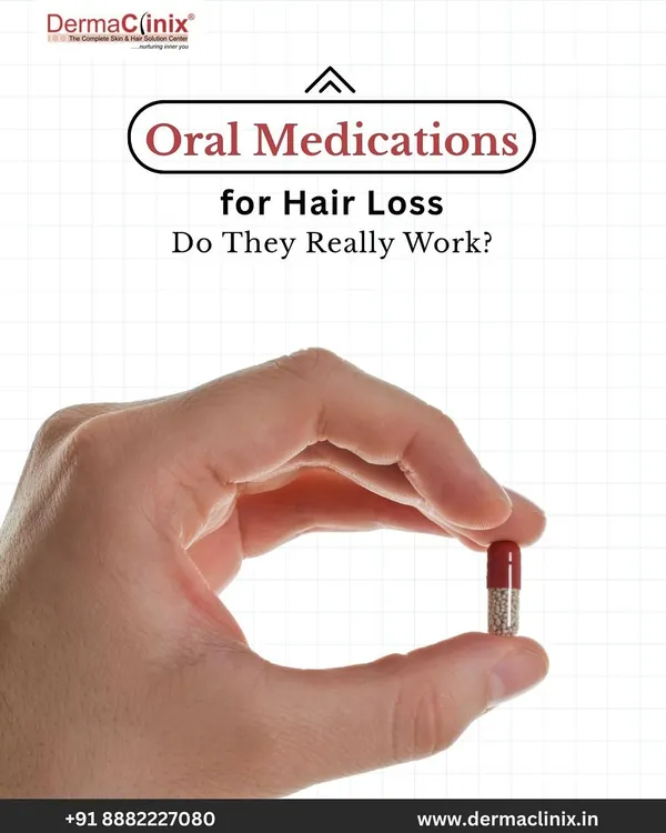 Do oral medications for hair loss really work? Yes, but only with the right diagnosis and expert care from a dermatologist.
