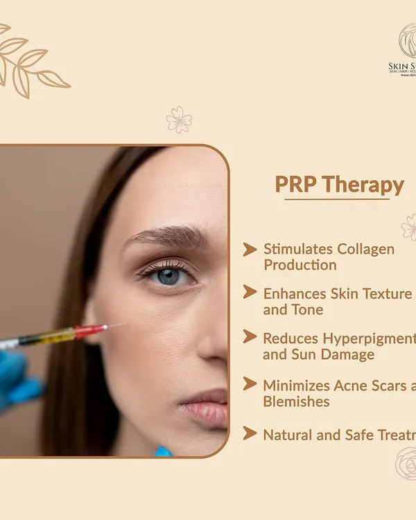 PRP Therapy is a natural and safe treatment that uses your body's own platelets to rejuvenate your skin. As shown here, it stimulates collagen, enhances texture, reduces hyperpigmentation, and minimizes acne scars for a truly revitalized appearance.