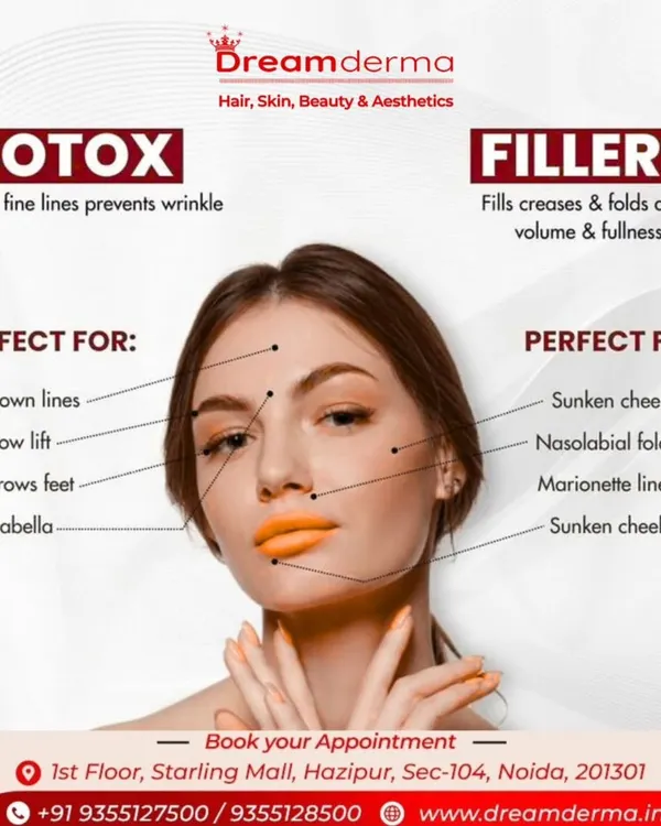 This helpful chart explains the difference between Botox and Fillers. I use Botox to smooth lines caused by muscle movement and Fillers to address volume loss and deeper folds.