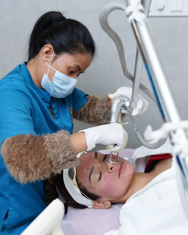 An expert therapist performs a fractional laser treatment. This technology is highly effective for targeting skin imperfections like fine lines and acne scars, revealing smoother and more youthful skin.