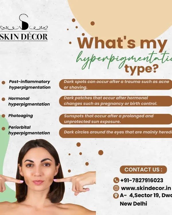 Hyperpigmentation is not a single condition. This graphic explains the different types I commonly see, from post-inflammatory marks left by acne to hormonal patches and sunspots. Knowing your type is the first step toward effective treatment.