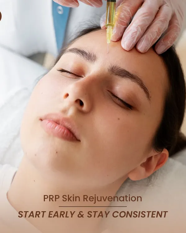 This image shows a PRP skin rejuvenation treatment in progress. I advise my patients to start early and stay consistent, as PRP is a regenerative therapy that builds and preserves skin structure over the years.