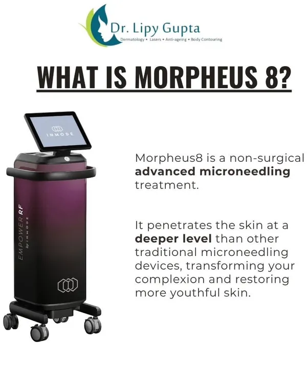 What is Morpheus8? It's an advanced, non-surgical microneedling treatment that penetrates deeper than traditional devices to transform your complexion and restore more youthful skin.