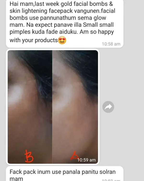 A customer was so happy with the results from my Gold Facial Bombs and Skin Lightening Facepack that she shared this before and after picture. You can see how her skin looks clearer and has a beautiful glow, with even small pimples fading away.
