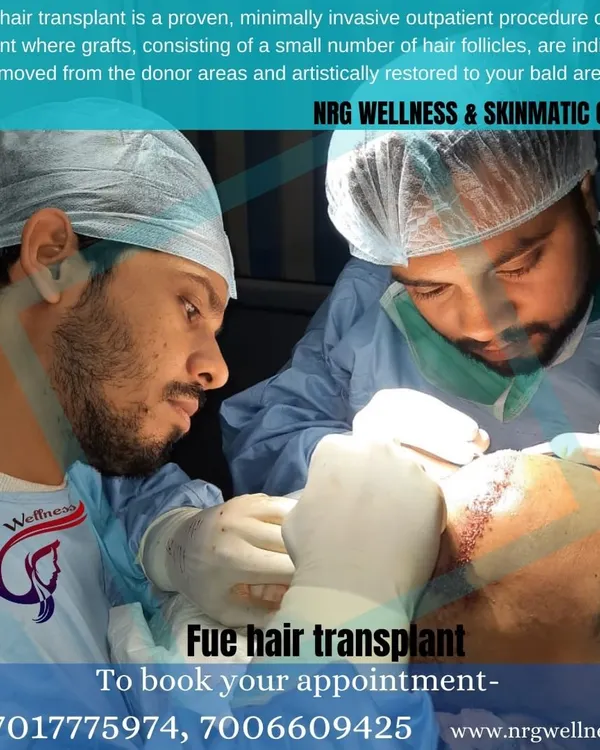 Our surgeons perform every FUE hair transplant with meticulous care. This image captures the focus and expertise required to artistically restore hair follicles to the bald area for a natural growth pattern.