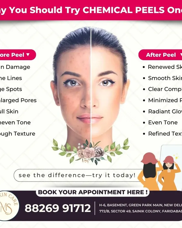 This graphic clearly shows the transformative effects of a chemical peel. It's an excellent treatment for sun damage, fine lines, and uneven tone, revealing renewed, smoother, and more radiant skin.