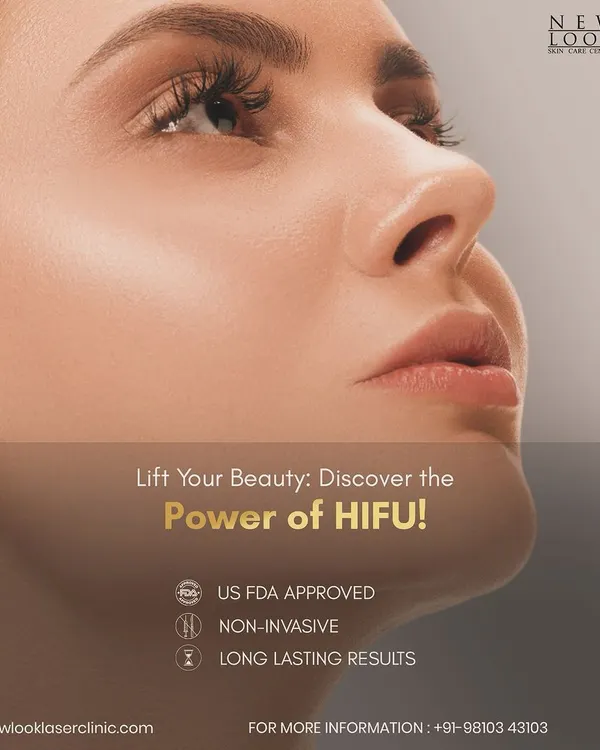 This is our High-Intensity Focused Ultrasound (HIFU) treatment, a US FDA-approved technology for non-invasive facelifting. It's one of our most popular services for achieving a tighter, more defined jawline and reducing sagging skin without any surgery or downtime.