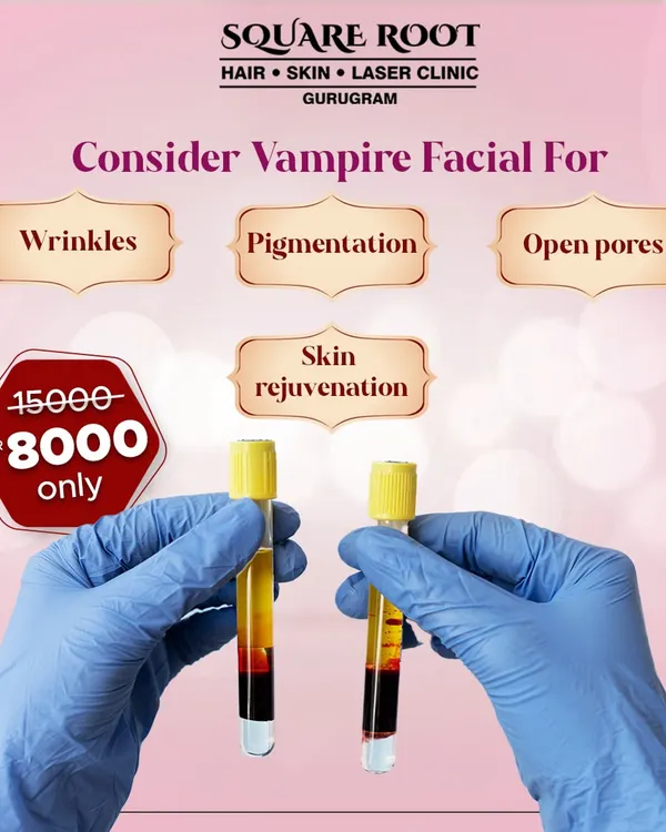 The Vampire Facial, or PRP, is a powerful skin rejuvenation treatment. This graphic shows the test tubes containing the client's own blood, which has been processed to concentrate the platelets and growth factors used in the facial.