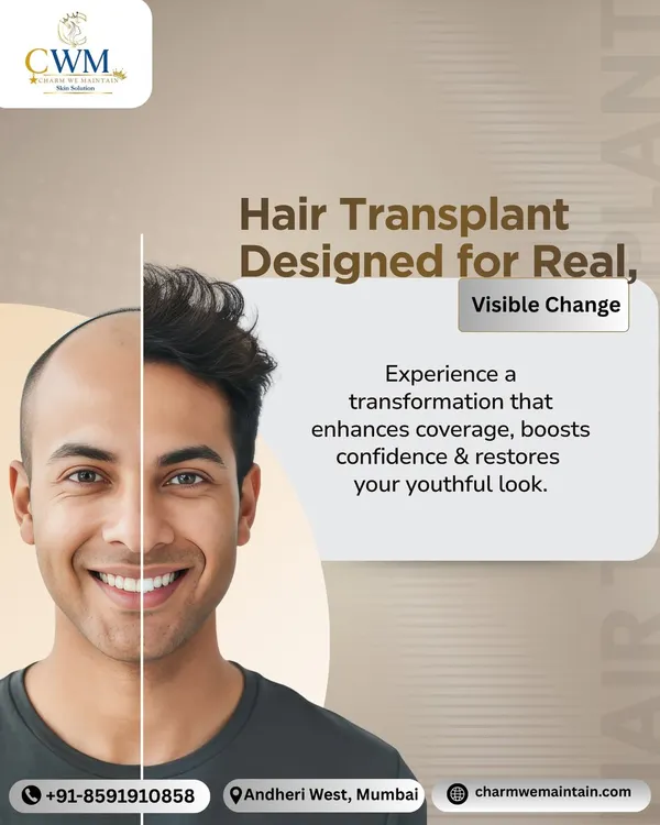 This is the transformation I aim for. It's not just about adding hair, but about restoring a youthful look and the confidence that comes with it. This split-view shows the visible change possible with our MicroFUE hair transplant.