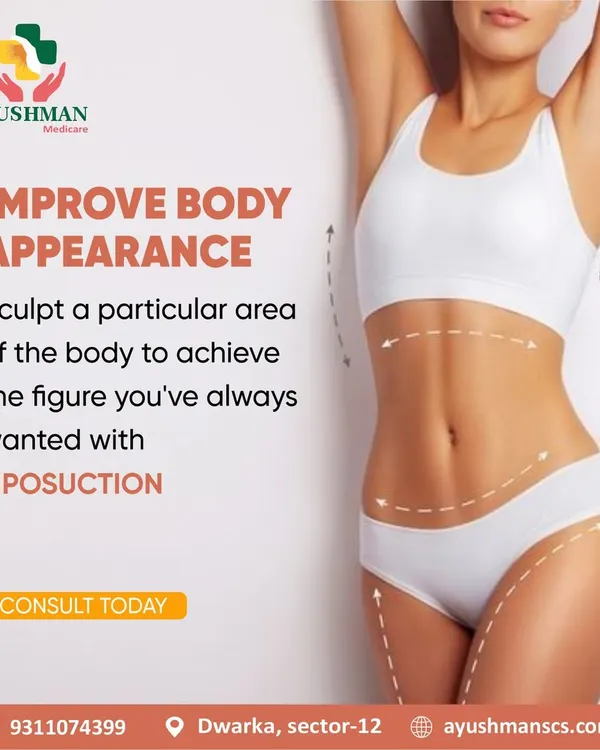With liposuction, you can sculpt a particular area of the body to achieve the figure you have always wanted. This surgical procedure is designed to remove stubborn fat deposits and improve your overall body appearance and proportions.
