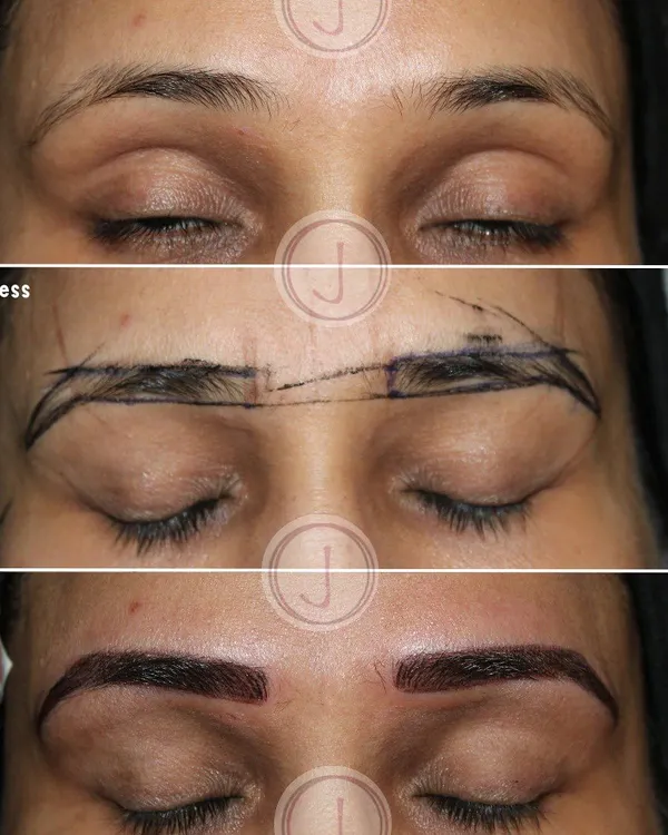 This is the journey to perfect, natural-looking eyebrows. The first image shows the client's original brows. In the middle, you can see the crucial mapping step where I design the ideal shape to complement your facial structure. The final image shows the beautifully defined, smudge-proof result after the permanent makeup procedure.