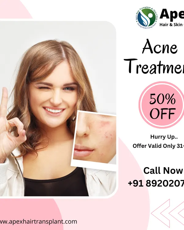 Don't let acne control your confidence. We offer dermatologist-led acne treatments that are non-invasive and designed to deliver clear results. This image highlights the transformative effect of our targeted solutions, helping you move towards blemish-free skin.