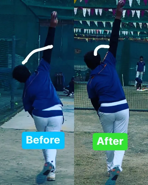A small adjustment can make a big difference. This before and after image shows how we corrected a bowler's arm alignment for a more efficient and powerful action.