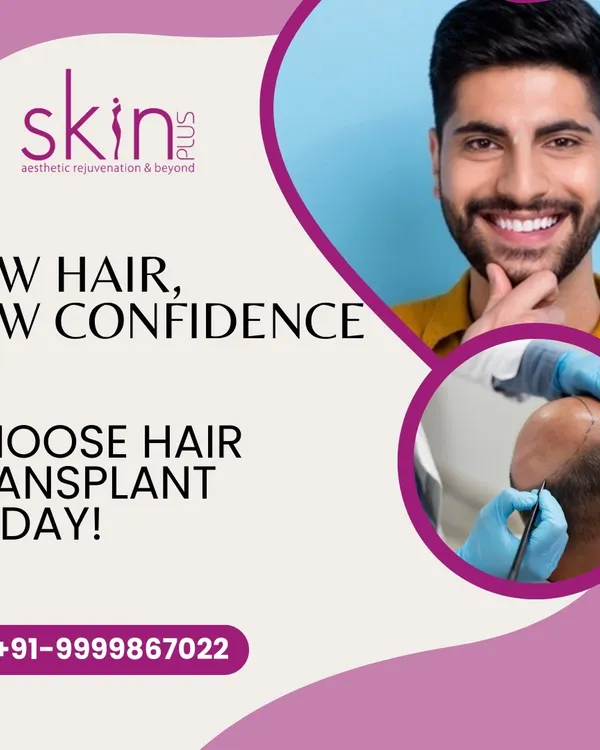 For those seeking a permanent solution to hair loss, I offer hair transplant surgery. This procedure provides natural, long-lasting results that can restore your hairline and your confidence.