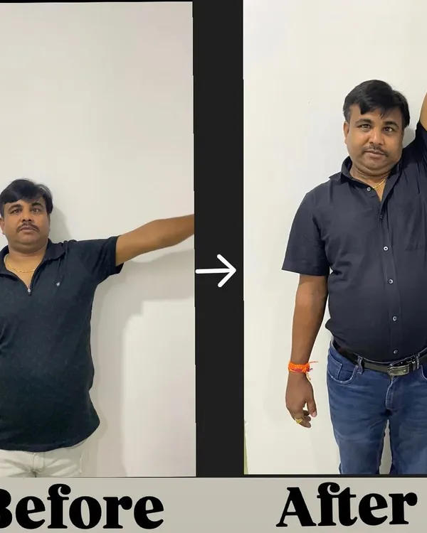 Before and After: Mr. Hukum, age 48, came to us with a severe frozen shoulder, limiting his daily activities. After dedicated therapy, he achieved a full, pain-free range of motion.