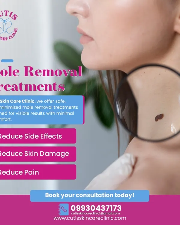 If you're concerned about a mole, our treatments are designed for your peace of mind. We focus on scar-minimized procedures that reduce side effects, skin damage, and pain, all under expert dermatological supervision for visible, safe results.
