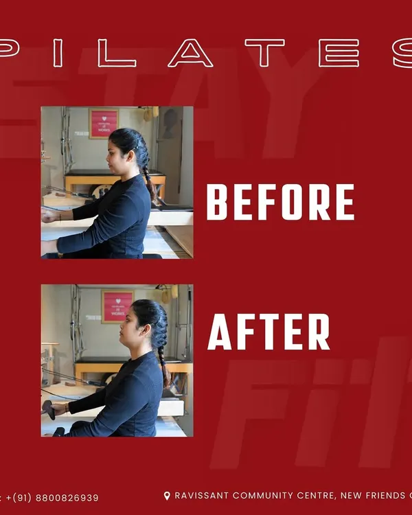 The results speak for themselves. This before and after shot shows a significant improvement in posture and spinal alignment after consistent Pilates sessions, highlighting a key benefit of the practice.