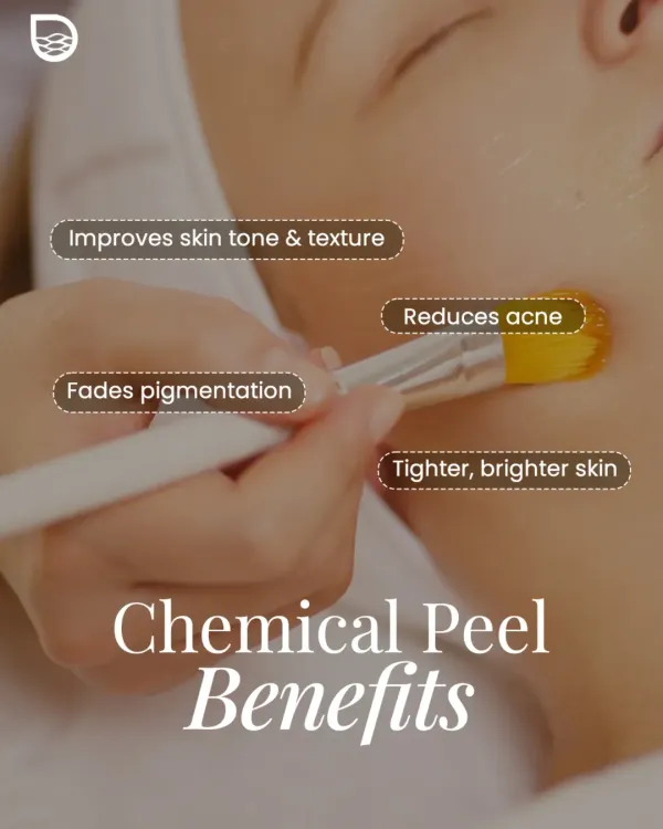 A chemical peel is a powerful tool for skin renewal, as shown in this treatment application. I use specific formulations to improve skin tone and texture, reduce active acne, fade post-inflammatory pigmentation, and reveal tighter, brighter skin.