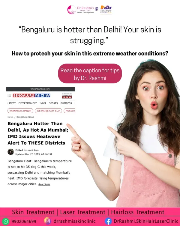 Bengaluru's weather has been getting hotter, and your skin is feeling it. To protect your skin in these extreme conditions, it is crucial to hydrate, use a high-SPF sunscreen, switch to lightweight products, and avoid peak sun hours.