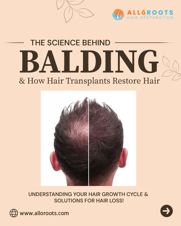 This graphic introduces the science behind balding. Understanding your hair growth cycle and the factors that disrupt it is the first step toward finding an effective solution.