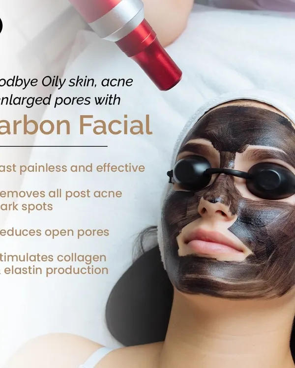 The Carbon Facial is a fast, painless, and effective solution for oily skin, acne, enlarged pores, and post-acne dark spots. It works by stimulating collagen and deeply cleansing the skin.