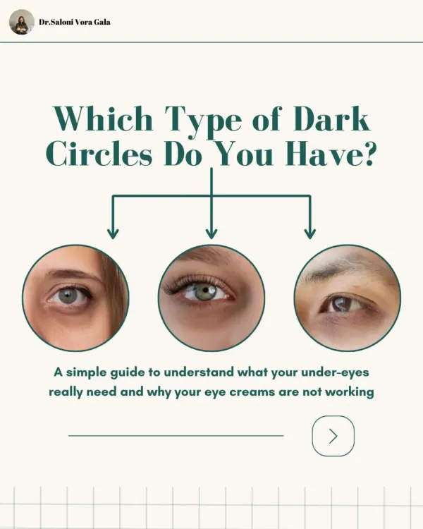 Not all dark circles are the same, which is why your eye cream might not be working. This simple guide will help you understand what your under-eyes really need by identifying the type of dark circle you have.