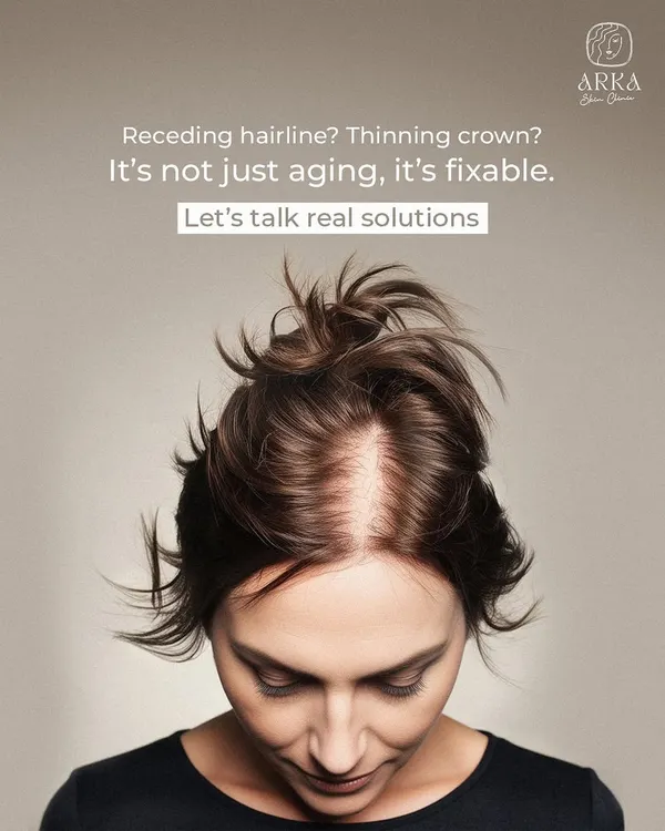 A receding hairline or a thinning crown is not just a sign of aging; it's a treatable medical condition. Let's move past temporary fixes and talk about real, evidence-based solutions like PRP and medication to restore your hair.