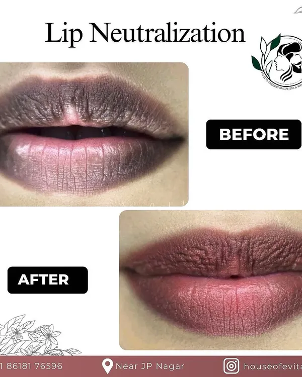 A close-up of a Dark Lip Correction, also known as Lip Neutralization. I used specialized pigments to counteract the darker tones, resulting in a much more even and healthy-looking lip color.