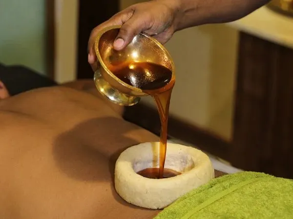 This is Kati Basti, one of the most effective treatments I provide for chronic lower back pain. We create a reservoir from dough on the lumbar region and fill it with warm, medicated oil. This process deeply nourishes the tissues, relieves muscle spasms, and provides significant relief for conditions like sciatica and spondylosis.