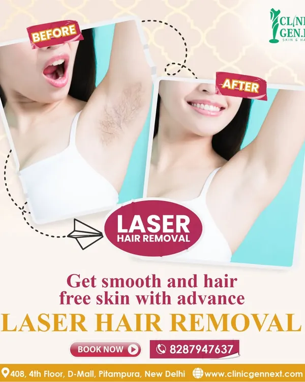 This is the result I aim for: smooth, clear, hair-free skin without the irritation of shaving or waxing. This before and after image shows the effectiveness of our advanced laser hair removal for the underarm area, a common concern for many.